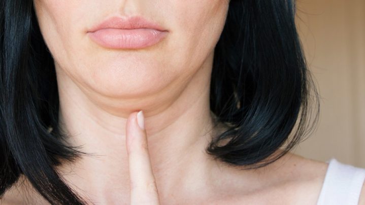 Exercises to get rid of double chin
