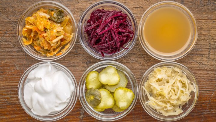 Some best probiotic foods to improve digestion
