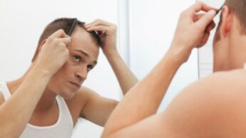 5 reasons why baldness is caused
