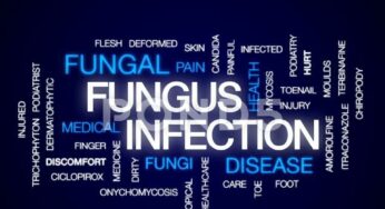 Simple Home Remedies To Deal With Fungus