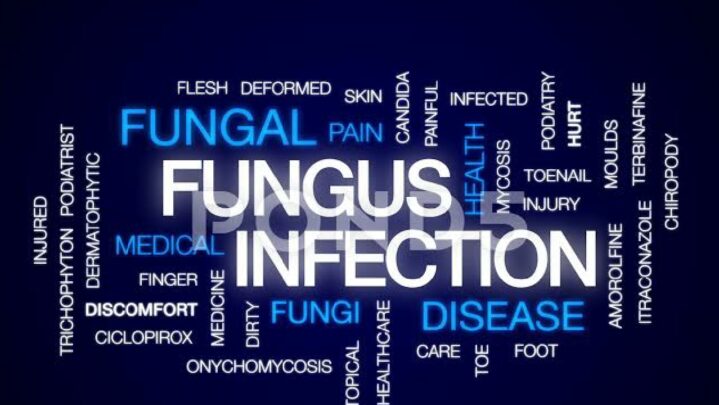 Simple Home Remedies To Deal With Fungus