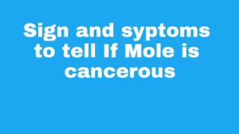 Signs & Symptoms To Tell If Mole Is Cancerous