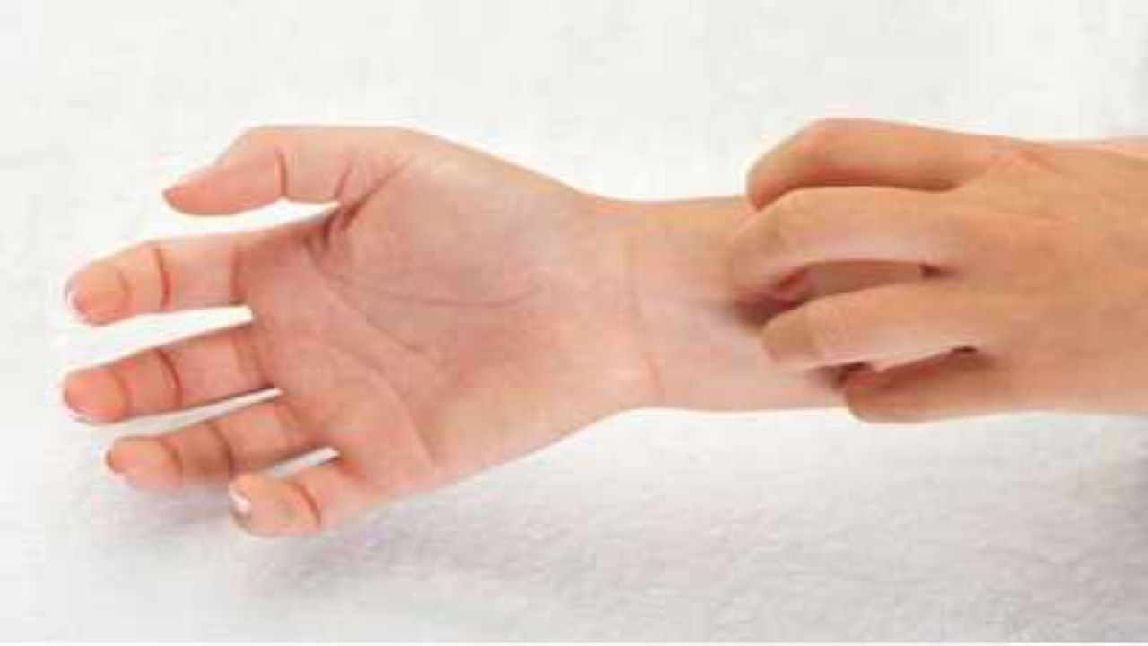 Swollen And Itchy Fingers Causes And Treatment SuccessYeti
