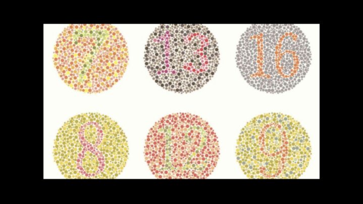 Colour Blindness: Causes And Types