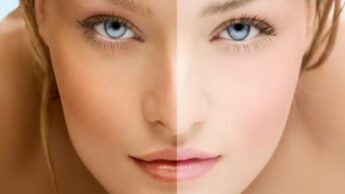 Simple Ways To Get A Fairer Skin