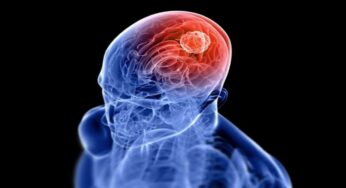 How To Reduce The Risk Of Stroke Easily?