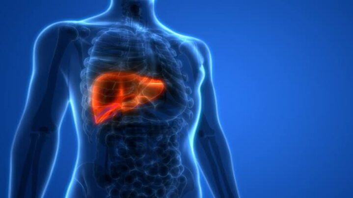 Cirrhosis: Diagnosis And Treatment