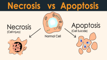 Necrosis vs. Apoptosis: Know The Differences