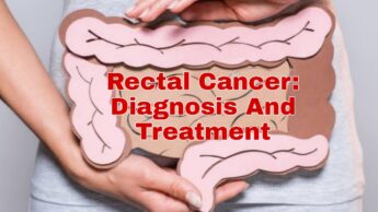Rectal Cancer: Diagnosis And Treatment- Part 2