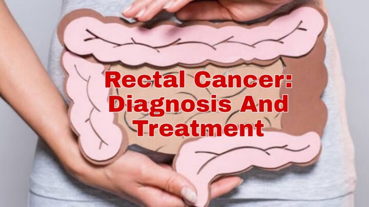 Rectal Cancer: Diagnosis And Treatment- Part 1