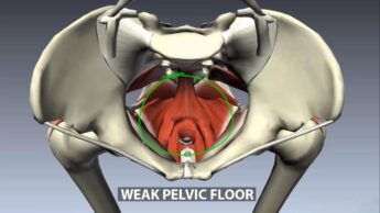 Signs And Symptoms Of Weak Pelvic Floor