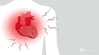 Did You Know: High Uric Acid May Lead To Heart Disease