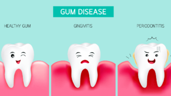 Gum Infection: Treatment And Symptoms