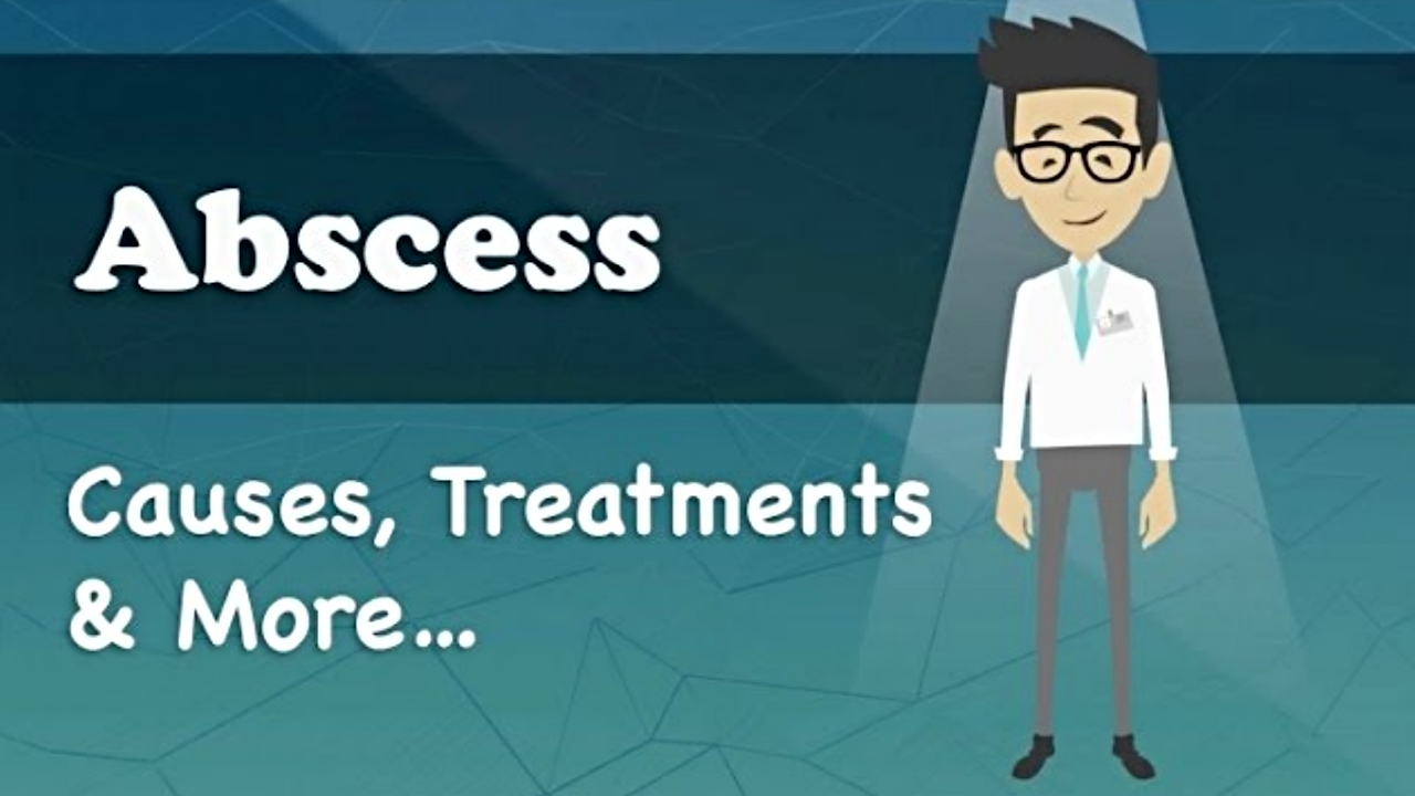 What Are The Causes Of Abscess & Are They Contagious? SuccessYeti