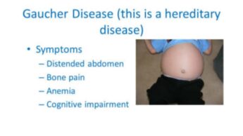 What Is Gaucher Disease? All You Need To Know