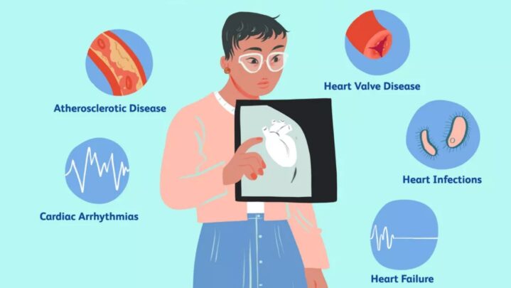 Different Types Of Heart Diseases: Read On
