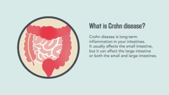 What Is Crohn Disease