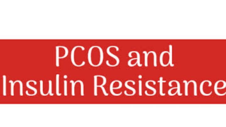 Insulin Resistance With PCOS? What Ties Them Together?