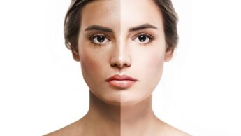 Tips To Avoid Tan This Summer