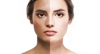 Tips To Help You Get Rid OF Summer Tan