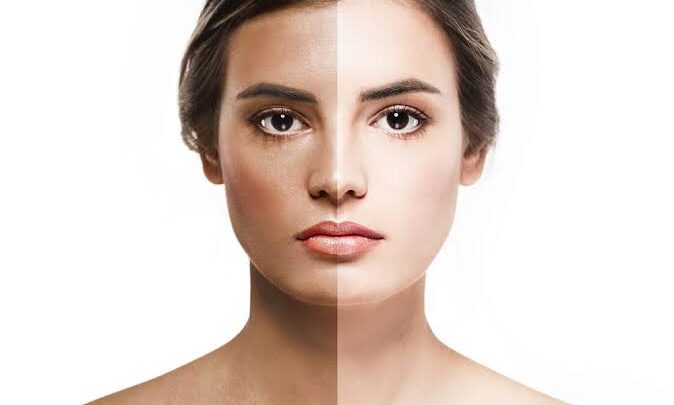 Tips To Help You Get Rid OF Summer Tan