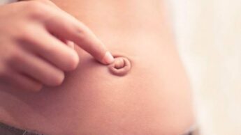 Umbilical Hernia: Causes And Symptoms