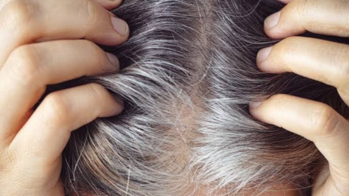 Why Does Our Hair Turn Gray? Know Here