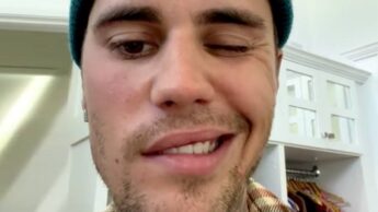 Ramsay Hunt Syndrome: Symptoms & Causes