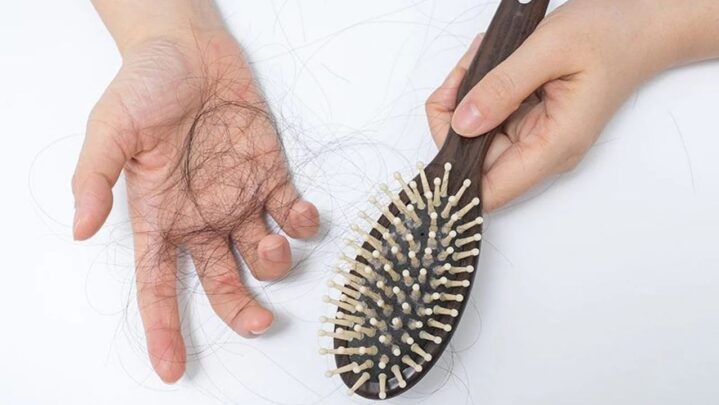 Do You Frequently Lose Your Hair When It Rains? Here’s How To Take Care Of It