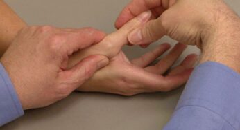 How Can You Tell If Your Finger Has Sprained? Read More