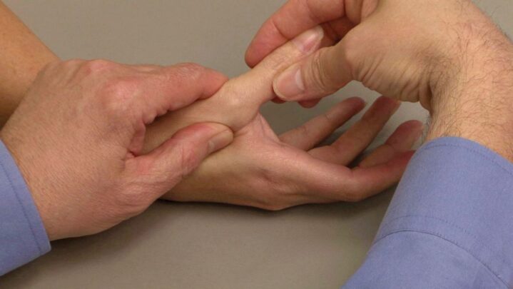 How Can You Tell If Your Finger Has Sprained? Read More