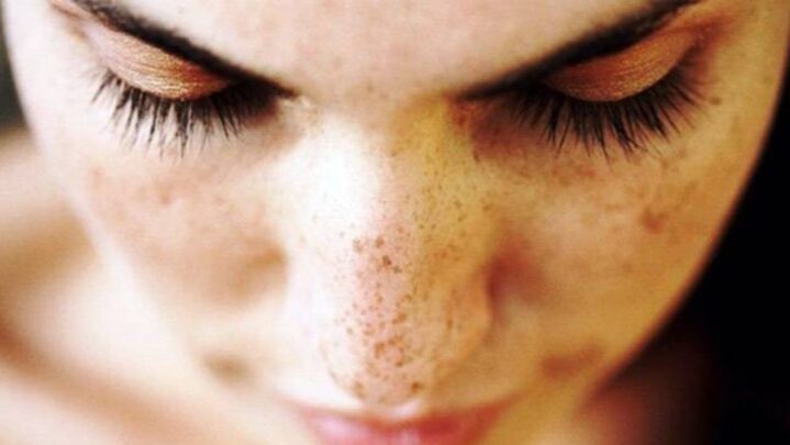 3 Mistakes Women Do That Affects The Dark Spots