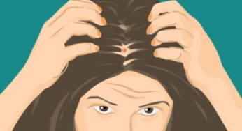 Acne On The Scalp? The Following Is How To Avoid It