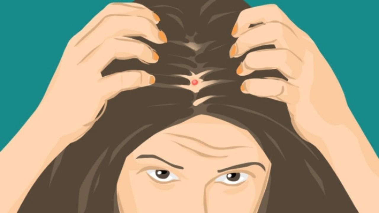 Acne On The Scalp? The Following Is How To Avoid It