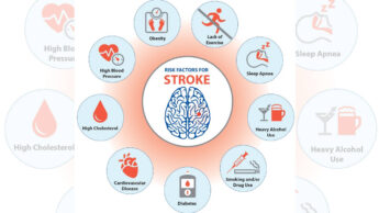 Do Diabetes And High Blood Pressure Increase The Risk Of Stroke?