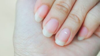 How To Treat White Spots On Your Nails And Why You Are Getting Them?