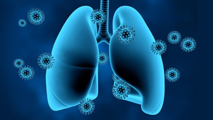 6 Symptoms Of Lung Damage
