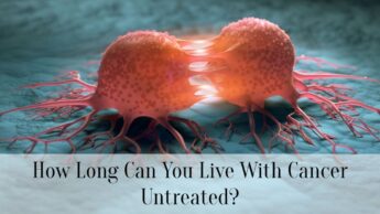 How Long Can You Live With Cancer Untreated?