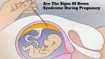 Are The Signs Of Down Syndrome During Pregnancy