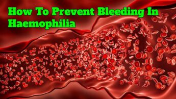 How To Prevent Bleeding In Haemophilia