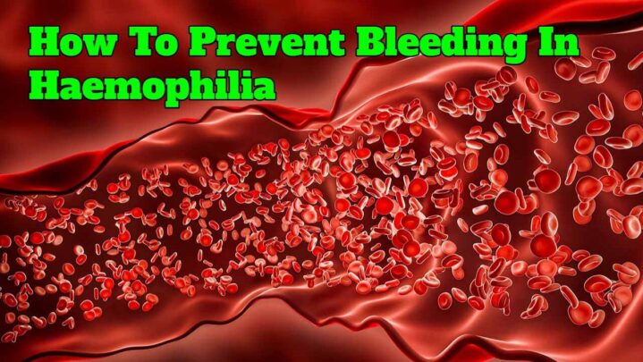 How To Prevent Bleeding In Haemophilia